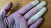 ¿Qué es el fenómeno de Raynaud? El trastorno que causa que los dedos se pongan blancos o azules