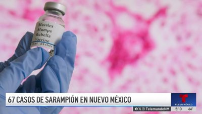 Casos de sarampión en Nuevo México